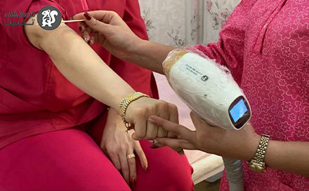 لیزر فول بادی در کلینیک زیبایی مانولیا